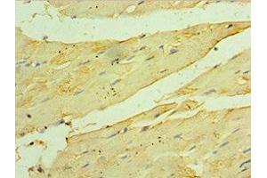 Immunohistochemistry of paraffin-embedded human skeletal muscle tissue using ABIN7154912 at dilution of 1:100 (HSPB2 anticorps  (AA 1-182))