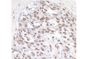 anti-Zinc Fingers and Homeoboxes 1 (ZHX1) (AA 1-50) antibody