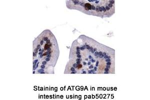 Image no. 2 for anti-ATG9 Autophagy Related 9 Homolog A (S. Cerevisiae) (ATG9A) (AA 750-839), (C-Term) antibody (ABIN363584)