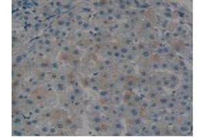 IHC-P analysis of Human Liver Tissue, with DAB staining. (Tissue factor anticorps  (AA 34-251))