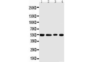Anti-TRAF4 antibody, Western blotting Lane 1: Rat Thymus Tissue Lysate Lane 2: HELA Cell Lysate Lane 3: JURKAT Cell Lysate Lane 4: HEPA Cell Lysate (TRAF4 anticorps  (C-Term))