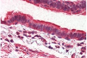 Lung, respiratory epithelium, Human: Formalin-Fixed, Paraffin-Embedded (FFPE) (ADGRV1 / GPR98 anticorps  (Internal Region))