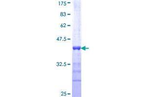 Image no. 1 for Topoisomerase (DNA) II Binding Protein 1 (TOPBP1) (AA 1327-1435) protein (GST tag) (ABIN1323353)