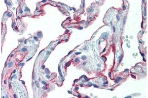 Human Lung (formalin-fixed, paraffin-embedded) stained with ICAM1 antibody ABIN462119 followed by biotinylated anti-mouse IgG secondary antibody ABIN481714, alkaline phosphatase-streptavidin and chromogen. (ICAM1 anticorps)