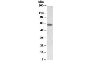 Western blot testing of MOLT4 lysate with SOX11 antibody at 0. (SOX11 anticorps)
