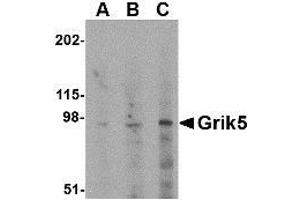 Western blot analysis of Grik5 in human brain tissue lysate with AP30386PU-N Grik5 antibody at (A) 0. (GRIK5 anticorps  (C-Term))