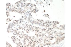 Immunohistochemistry (IHC) image for anti-Interleukin enhancer-binding factor 3 (ILF3) (AA 456-506) antibody (ABIN7453567) (Interleukin enhancer-binding factor 3 (ILF3) (AA 456-506) anticorps)