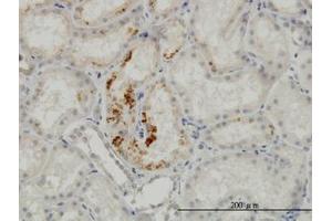 Image no. 2 for anti-Endothelial Cell-Specific Molecule 1 (ESM1) (AA 85-185) antibody (ABIN466176) (ESM1 anticorps  (AA 85-185))