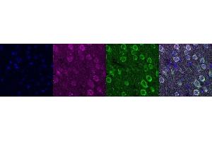 Immunohistochemistry (IHC) image for anti-Ubiquitin Carboxyl-terminal Esterase L1 (Ubiquitin Thiolesterase) (UCHL1) antibody (ABIN7456167) (UCHL1 anticorps)