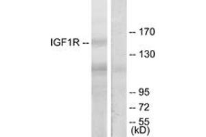 Western blot analysis of extracts from 293 cells, treated with Insulin, using IGF1R (Ab-1165/1166) Antibody. (IGF1R anticorps  (AA 1131-1180))