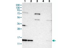 Western blot analysis of Lane 1: RT-4, Lane 2: U-251 MG, Lane 3: Human Plasma, Lane 4: Liver, Lane 5: Tonsil with SNRPD3 polyclonal antibody  at 1:250-1:500 dilution. (SNRPD3 anticorps)