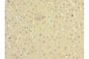 Immunohistochemistry of paraffin-embedded human liver tissue using ABIN7154980 at dilution of 1:100