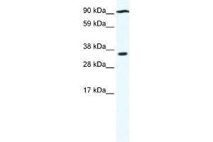 WB Suggested Anti-PAntibody Titration:  0. (PARP16 anticorps  (N-Term))