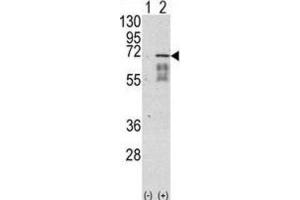 Western Blotting (WB) image for anti-Activin Receptor Type I (ACRV1) antibody (ABIN3002992) (ACVR1 anticorps)