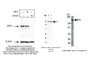 Image no. 5 for anti-Iron-Responsive Element Binding Protein 2 (IREB2) antibody (ABIN363497) (IREB2 anticorps)