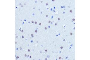 Immunohistochemistry of paraffin-embedded mouse brain using PI Rabbit pAb (ABIN6128450, ABIN6145596, ABIN6145597 and ABIN6221297) at dilution of 1:25 (40x lens).