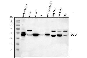 Western blot analysis of DOK7 using anti-DOK7 antibody (ABIN6719428).