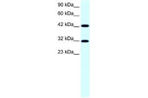 WB Suggested Anti-GTF2H2 Antibody Titration:  0. (GTF2H2 anticorps  (Middle Region))