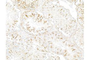 Immunohistochemistry (IHC) image for anti-Tubulin, beta (TUBB) (AA 1-50) antibody (ABIN7453995) (Recombinant TUBB anticorps  (AA 1-50))