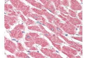 Human Heart (formalin-fixed, paraffin-embedded) stained with LGI4at 5 µg/ml followed by biotinylated goat anti-rabbit IgG secondary antibody, alkaline phosphatase-streptavidin and chromogen. (LGI4 anticorps)