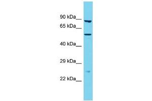 Western Blotting (WB) image for anti-Transmembrane Protease, Serine 9 (TMPRSS9) (N-Term) antibody (ABIN2790876) (TMPRSS9 anticorps  (N-Term))