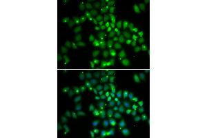 Immunofluorescence analysis of HeLa cells using PCGF6 antibody.
