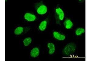 Image no. 4 for anti-Eukaryotic Translation Initiation Factor 2-alpha Kinase 2 (EIF2AK2) (AA 1-101) antibody (ABIN598901) (EIF2AK2 anticorps  (AA 1-101))