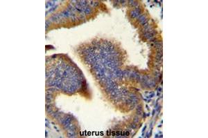 CCNB1 Antibody (C-term) immunohistochemistry analysis in formalin fixed and paraffin embedded human uterus tissue followed by peroxidase conjugation of the secondary antibody and DAB staining.