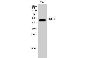 Western Blotting (WB) image for anti-Interferon Regulatory Factor 3 (IRF3) (Ser605) antibody (ABIN6283356)
