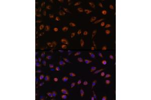 Immunofluorescence analysis of L929 cells using Connexin 43 Rabbit pAb (ABIN6131701, ABIN6141098, ABIN6141099 and ABIN6215448) at dilution of 1:100 (40x lens).