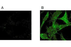Immunocytochemistry showing the detection of Tollip in Tollip -/- (A) or overexpressed Tollip in -/- (B) murine embryonic fibroblasts (MEF) cells with the MAb to Tollip (Kimmy-2) . (TOLLIP anticorps  (AA 1-274))