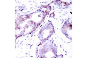 Immunohistochemistry (IHC) image for anti-Myc Proto-Oncogene protein (MYC) (pSer373) antibody (ABIN3019599)