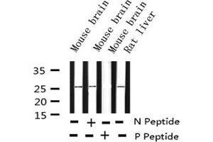 Western blot analysis of Phospho-eIF4E (Ser209) expression in various lysates (EIF4E anticorps  (pSer209))