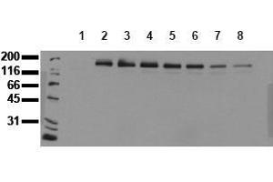 Western Blotting (WB) image for anti-Receptor tyrosine-protein kinase erbB-2 (ErbB2/Her2) (pTyr1248) antibody (ABIN126792) (ErbB2/Her2 anticorps  (pTyr1248))