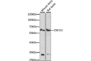 Western blot analysis of extracts of various cell lines, using ZNF331 antibody (ABIN7271477) at 1:1000 dilution. (ZNF331 anticorps  (AA 50-130))
