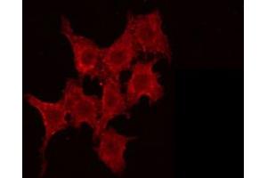 ABIN6266896 staining Hela by IF/ICC. (AKAP14 anticorps  (N-Term))