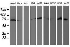 Image no. 4 for anti-Ribophorin 1 (RPN1) antibody (ABIN1500748) (RPN1 anticorps)