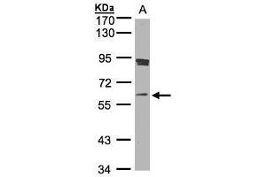 WB Image Sample(30 ug whole cell lysate) A:Raji , 7. (SCMH1 anticorps  (Center))