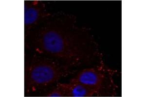 Image no. 1 for anti-Paxillin (PXN) (pTyr88) antibody (ABIN401593) (Paxillin anticorps  (pTyr88))