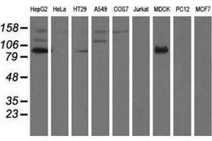 Western blot analysis of extracts (35 µg) from 9 different cell lines by using anti-ALDH1L1 monoclonal antibody. (ALDH1L1 anticorps)