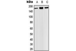 Western blot analysis of PHLPP expression in HEK293T (A), SP2/0 (B), PC12 (C) whole cell lysates.