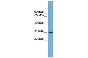 HLA-DQA2 antibody used at 1 ug/ml to detect target protein. (HLA-DQA2 anticorps  (N-Term))
