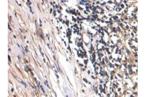 IHC-P analysis of Human Lymph node Tissue, with DAB staining. (CTGF anticorps  (AA 248-349))
