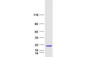 Validation with Western Blot