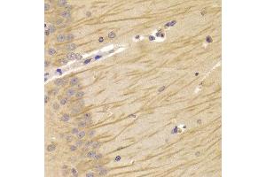 Immunohistochemistry of paraffin-embedded Mouse brain using TCN2 antibody at dilution of 1:100 (x400 lens). (TCN2 anticorps)