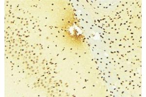 ABIN6276374 at 1/100 staining Mouse brain tissue by IHC-P.