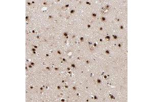 Immunohistochemical staining of human cerebral cortex with RBM22 polyclonal antibody  shows strong nuclear positivity in neuronal cells at 1:20-1:50 dilution. (RBM22 anticorps)