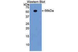 Western Blotting (WB) image for anti-Integrin beta 2 (ITGB2) (AA 124-363) antibody (ABIN1859504) (Integrin beta 2 anticorps  (AA 124-363))