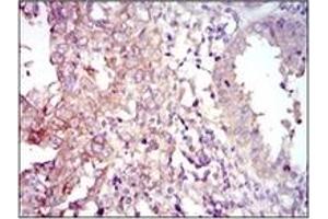 Immunohistochemistry (IHC) image for anti-Forkhead Box O1 (FOXO1) antibody (ABIN1107270)