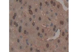 Used in DAB staining on fromalin fixed paraffin- embedded Kidney tissue